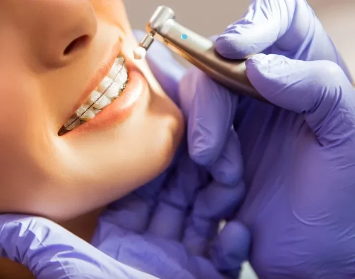 igiene dentale - prevenzione e cura dei denti - Montepulciano