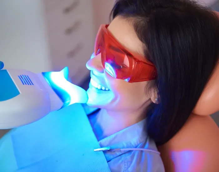 Sbiancamento denti - studio dentistico Montepulciano