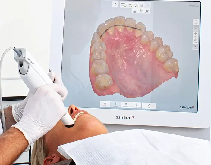Trios 3 Shape Dental 3D scanner